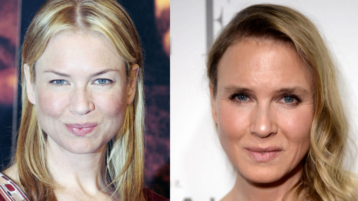Renee Zellweger Opens Up About Why Her Face Looks Different