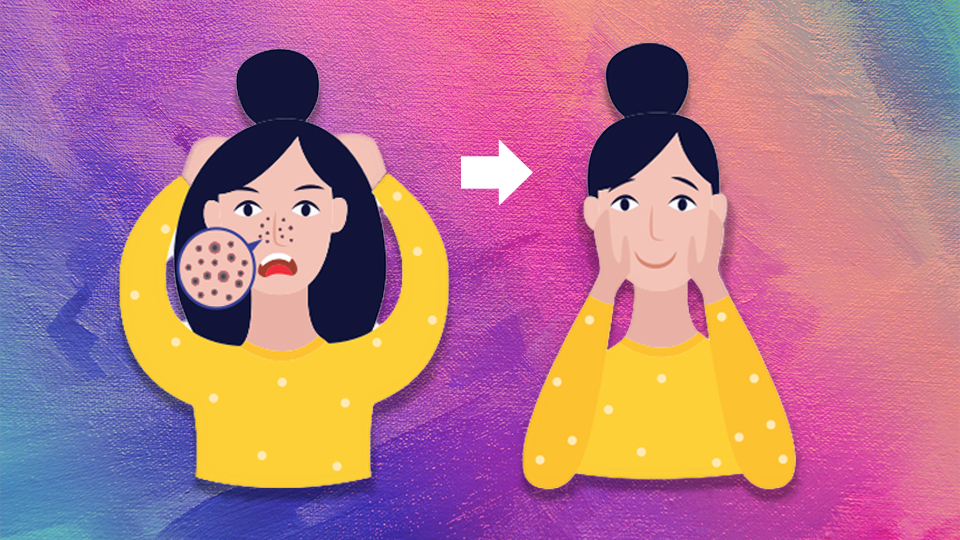 blackhead removal tool