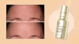 dr. dennis gross serum