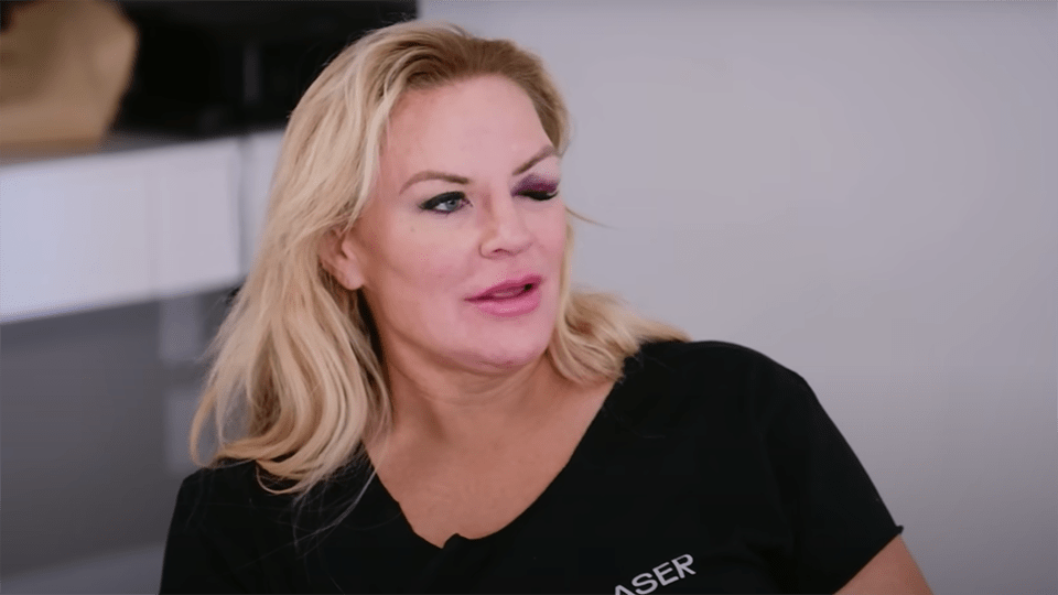 Heather Gay Black Eye