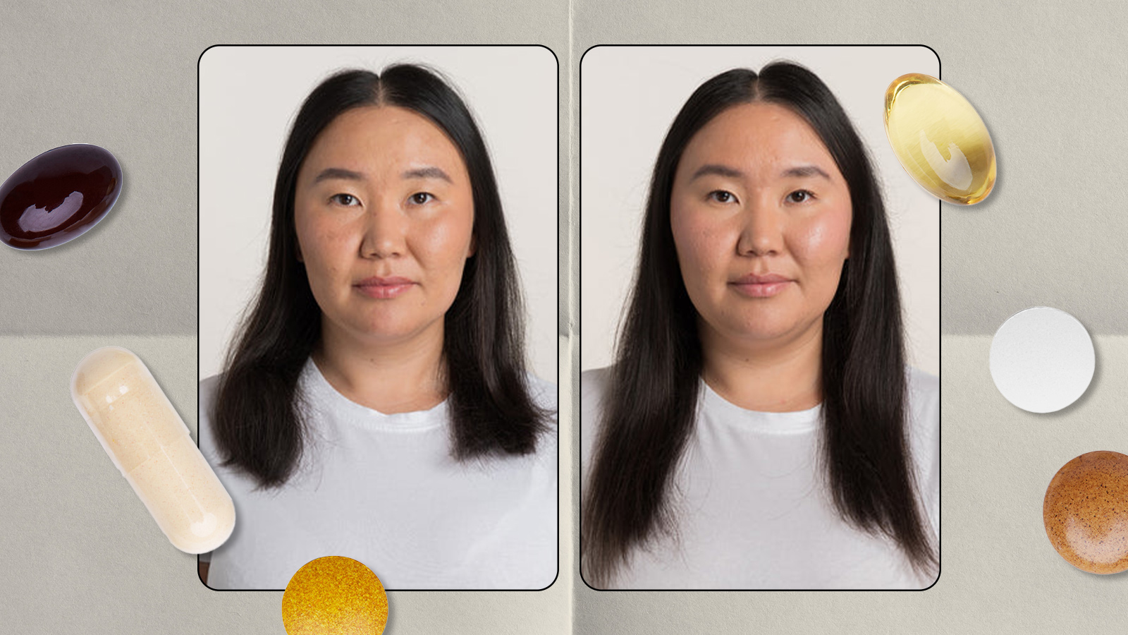 Before and after photos of a woman who used Vegamour’s GRO+ Advanced Hair Growth & Density Supplements